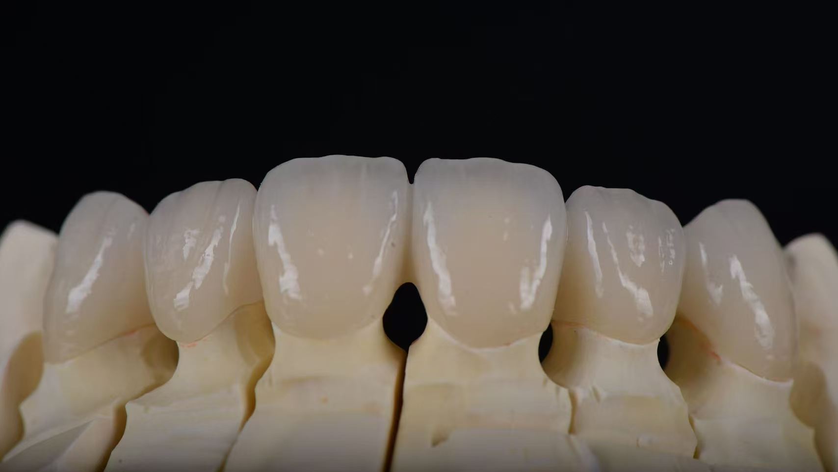 Zirconia Crown & Bridge