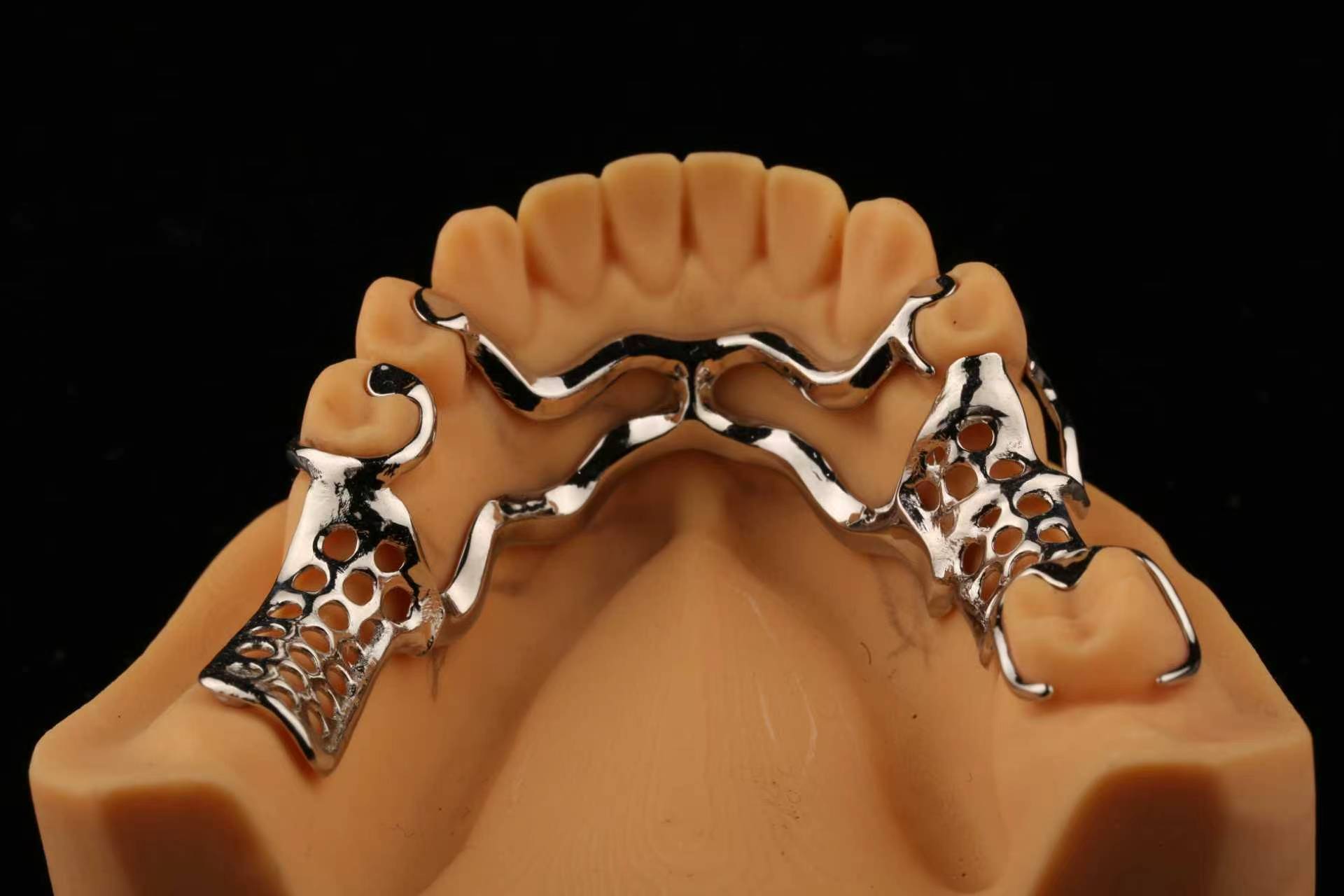 Cast Metal Partial Denture