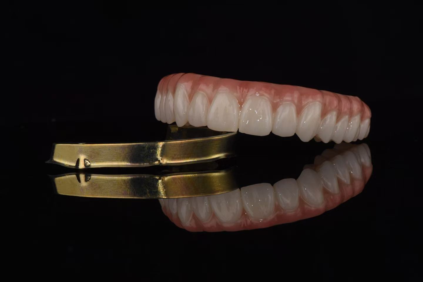 Implant Full Arch Hybrid Bridge