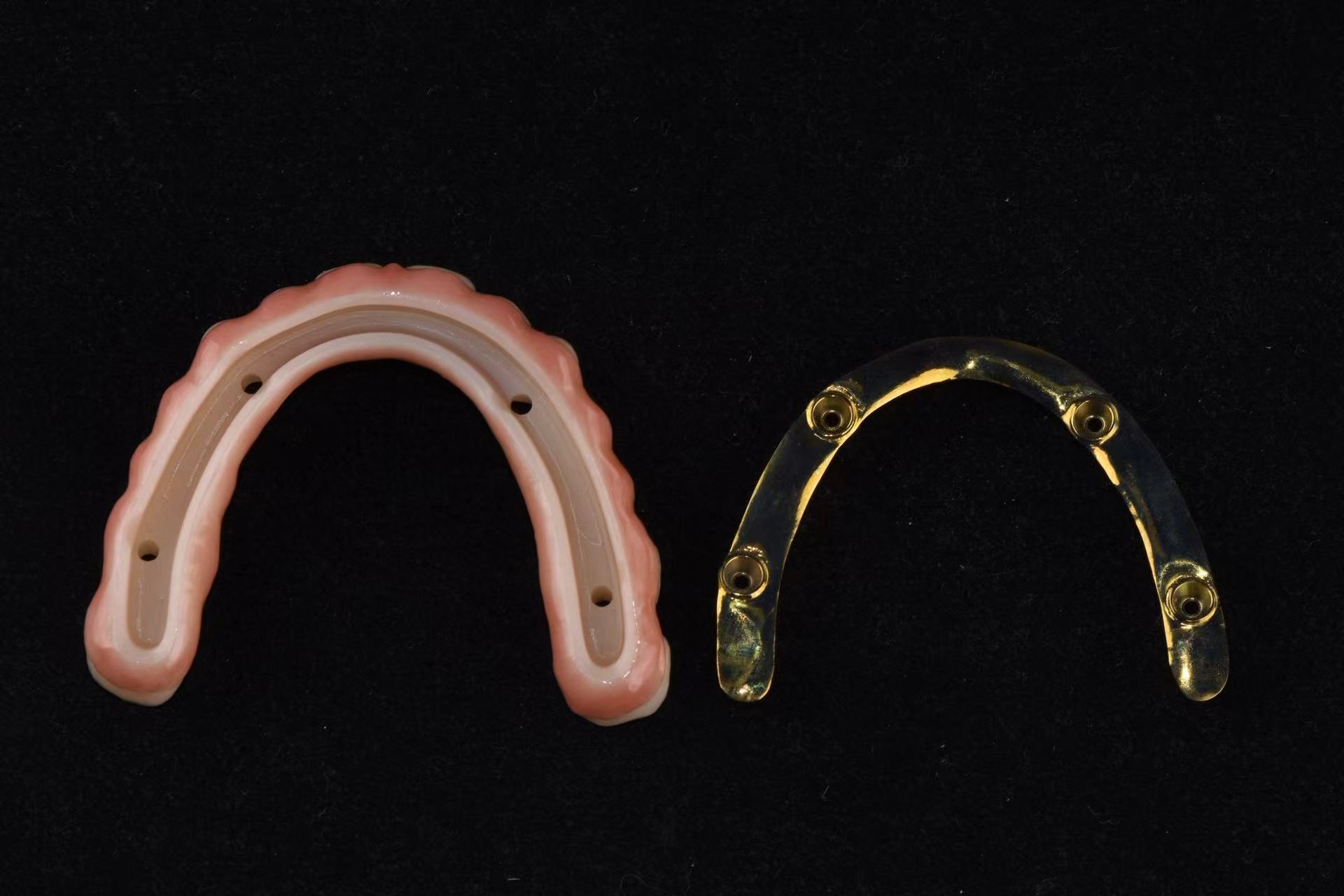 Implant Full Arch Hybrid Bridge