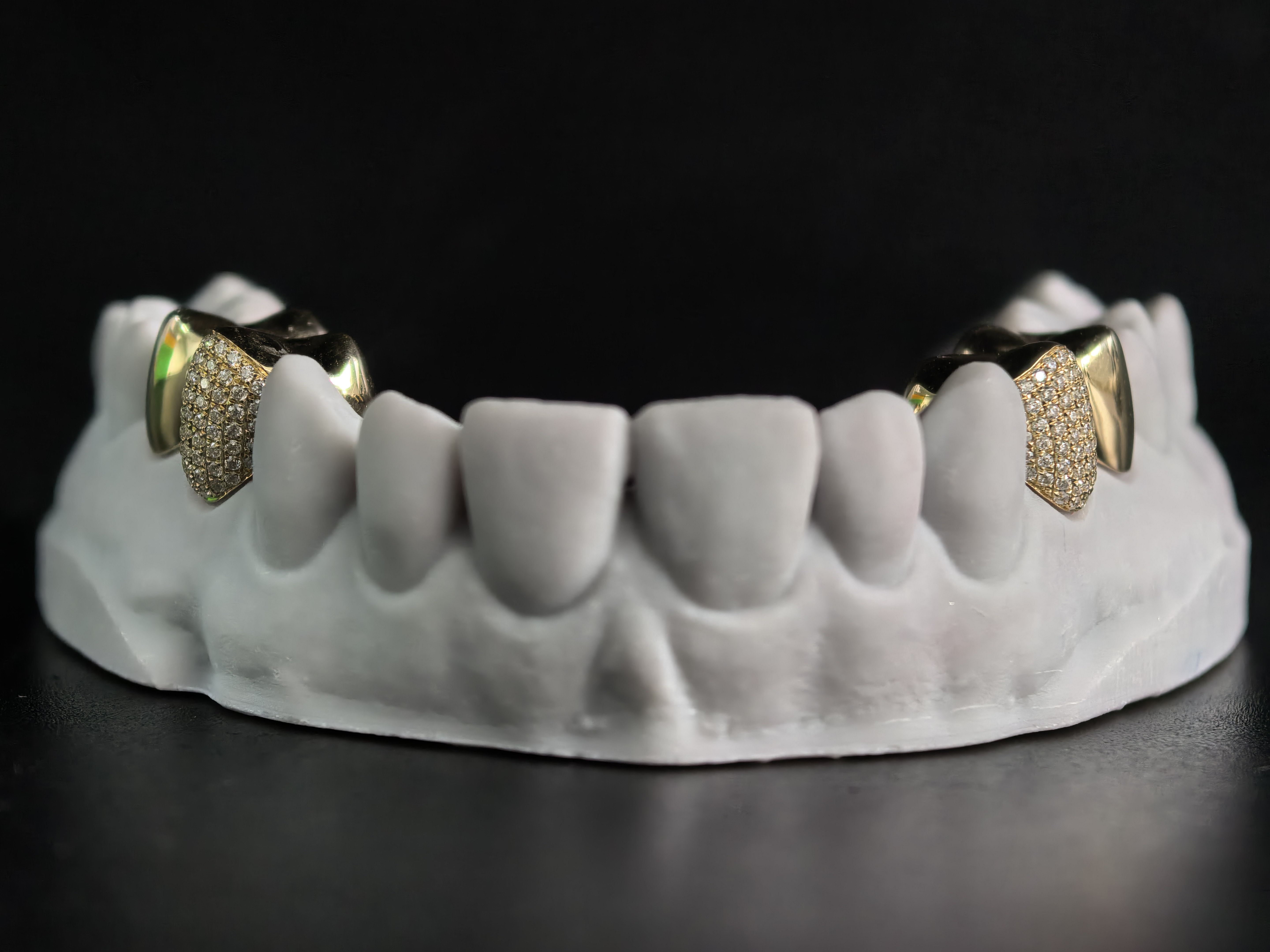 Moissanite Inlaid Gold Crown