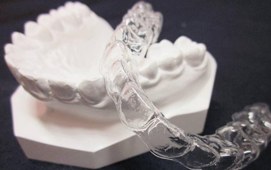 Orthodontic Retainer