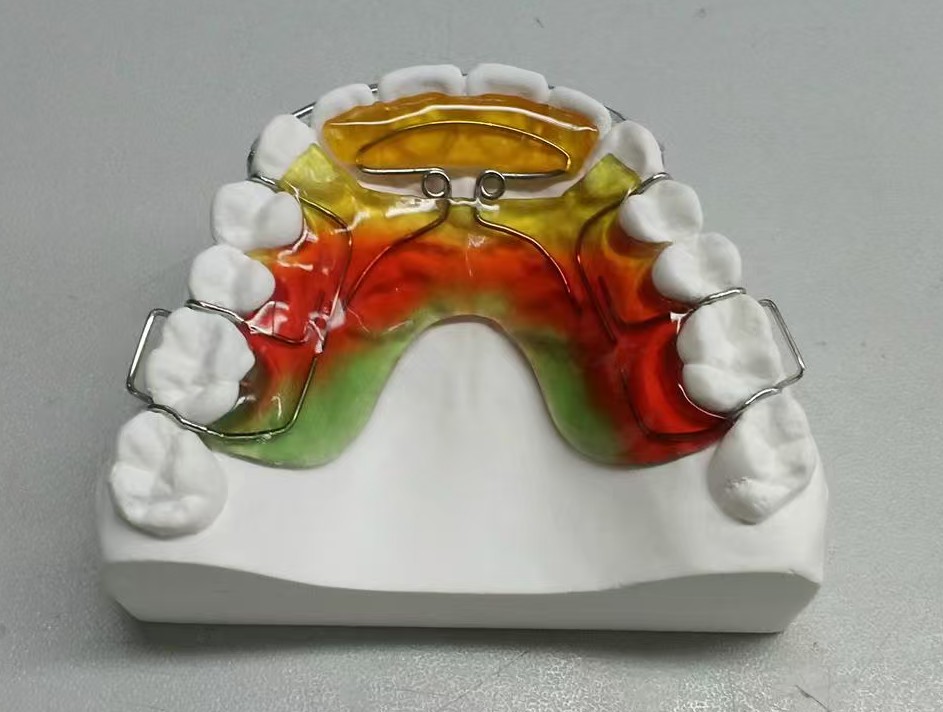 Orthodontic Retainer