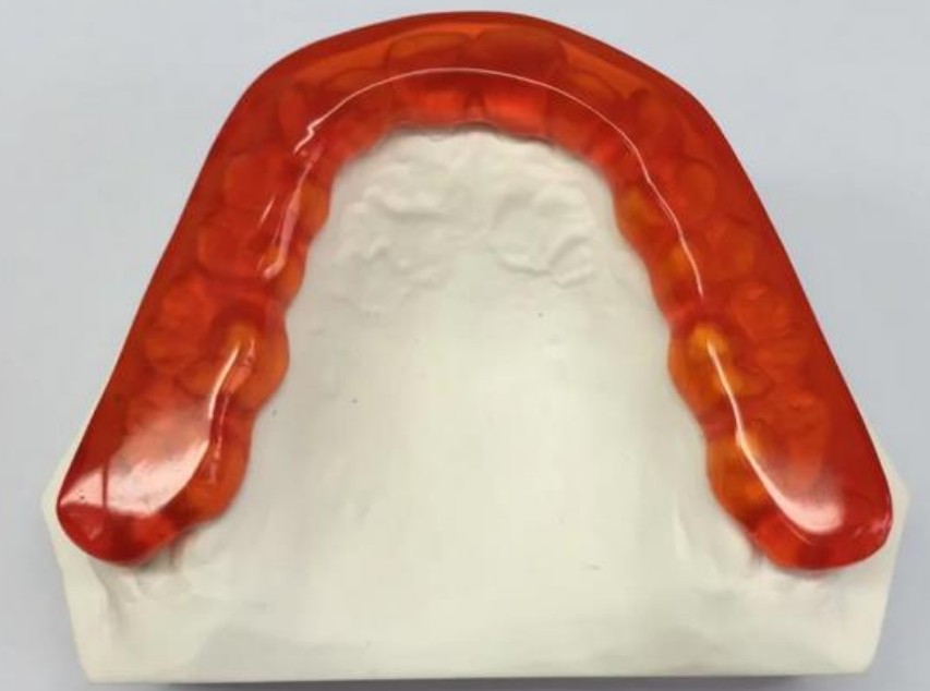 Flexible Partial Denture