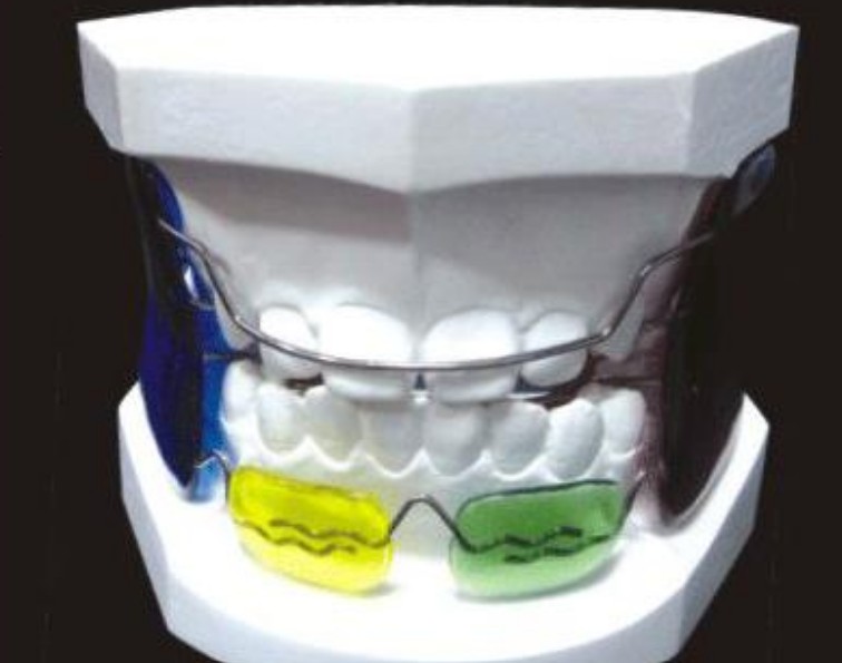 Flexible Partial Denture